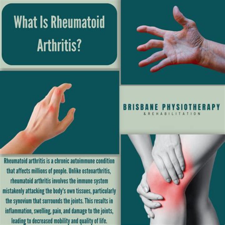 Does tramadol Make your joints hurt?