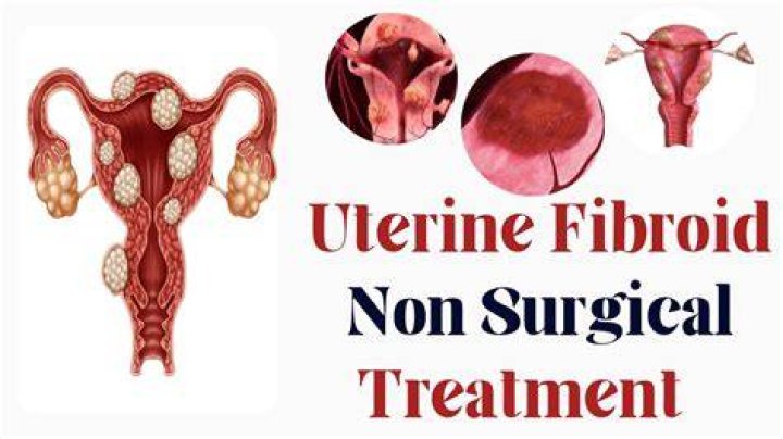 Does tumeric help with fibroids?