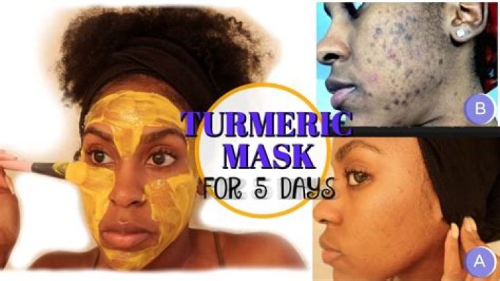 Does turmeric remove dark spots?