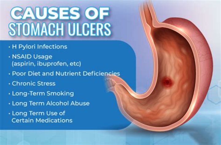 Does ulcer pain get worse lying down?