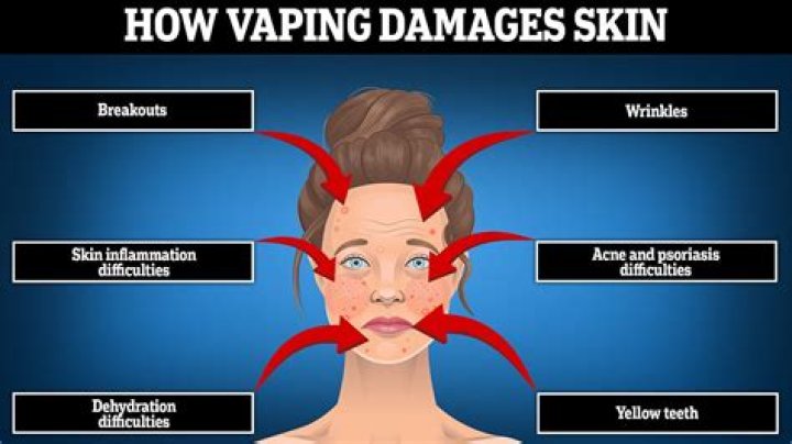 Does vaping affect skin?