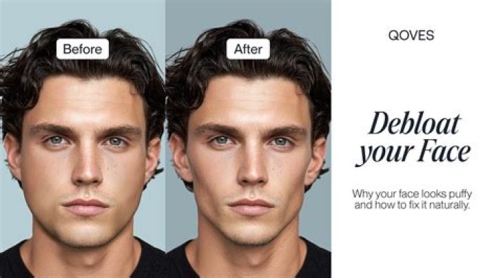 Does wine bloat your face?