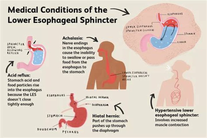 Does your sphincter loosen with age?