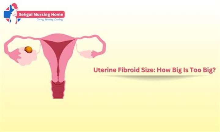 How big is too big vaginal delivery?
