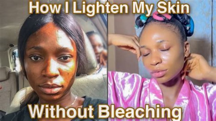 How can I bleach my skin naturally?