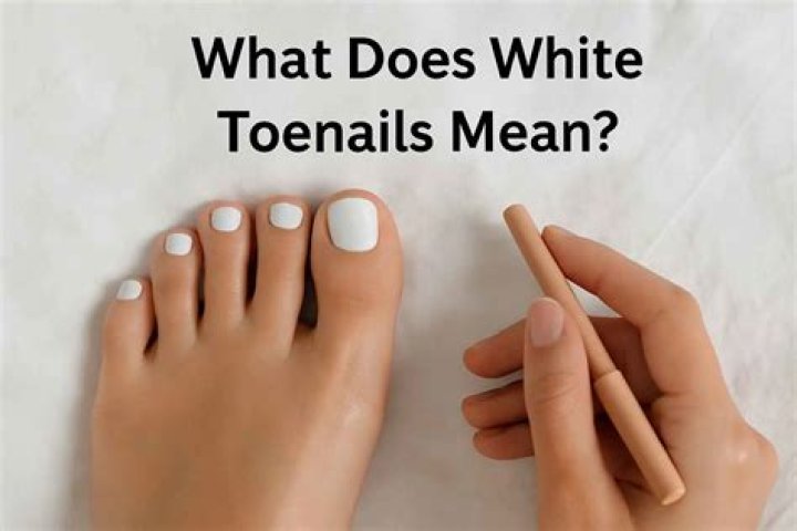 How can I make my toenails white?