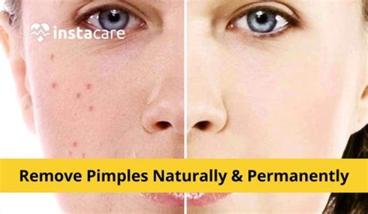 How can I remove my eyes number naturally?