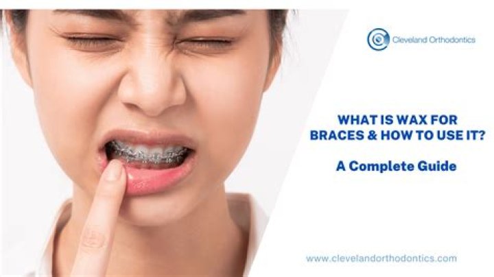 How can I stop my braces rubbing on my cheeks without wax?