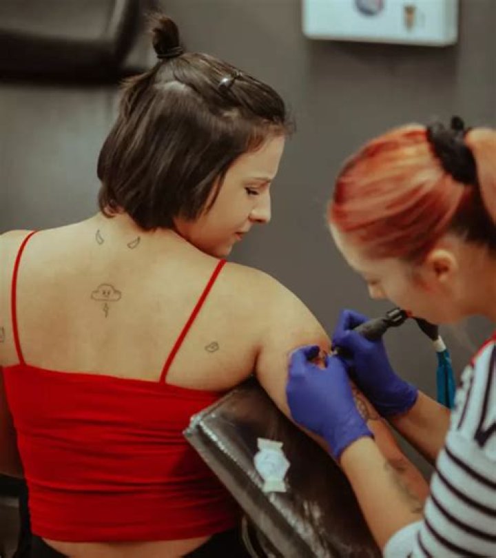 How can u remove tattoos?
