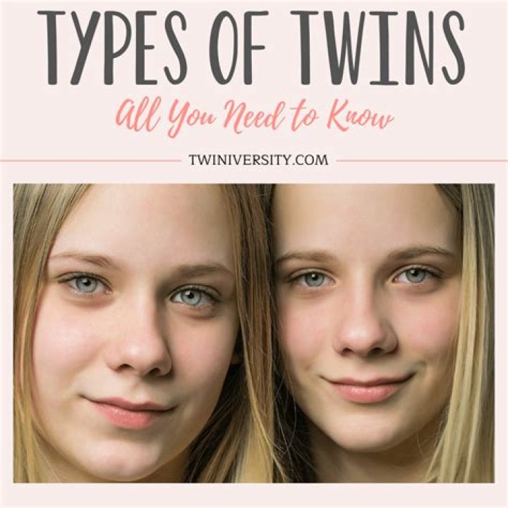 How common are twins naturally?