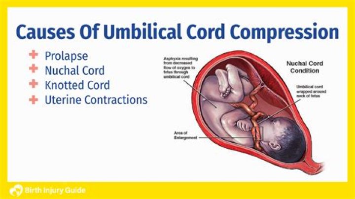 How common are umbilical cord problems?