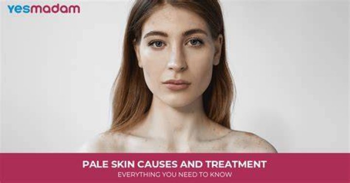 How do I become pale?