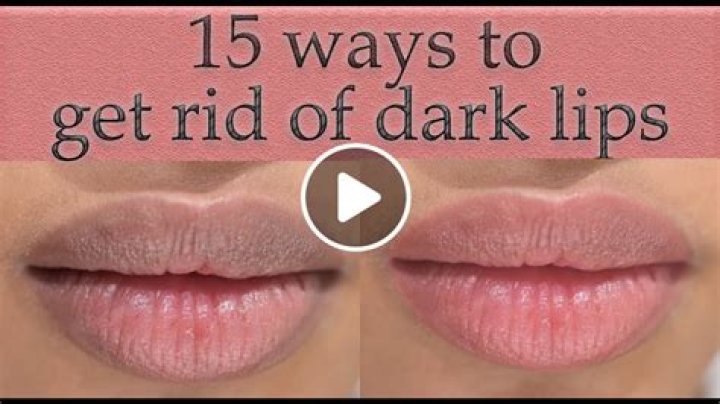 How do I get rid of dark lips permanently?