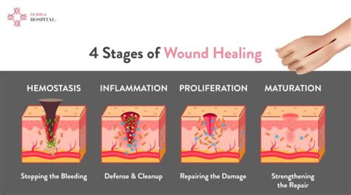 How do I get Voriplasm?