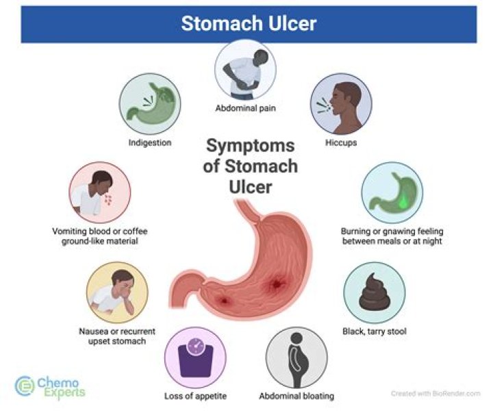 How do I know if I have an ulcer or acid reflux?