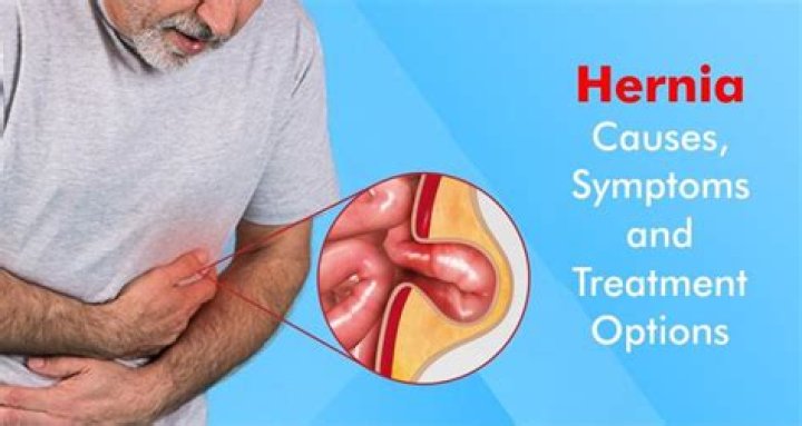 How do I know if my hernia is getting worse?