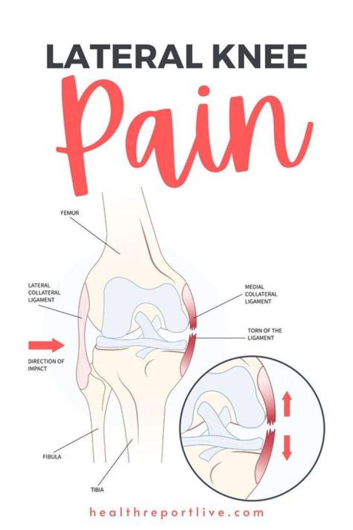 How do I know if my knee pain is serious?