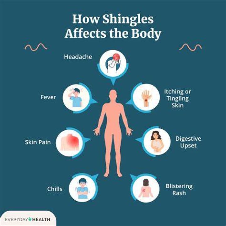 How do I know if my rash is shingles?