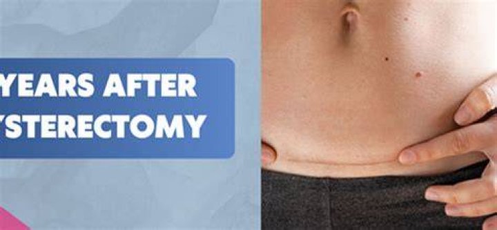 How do I lose my belly after a hysterectomy?