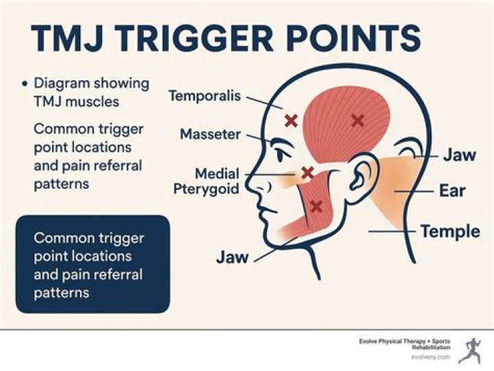 How do I permanently get rid of TMJ?