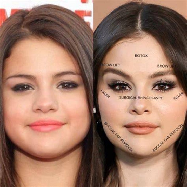 How do I tell my kids about plastic surgery?
