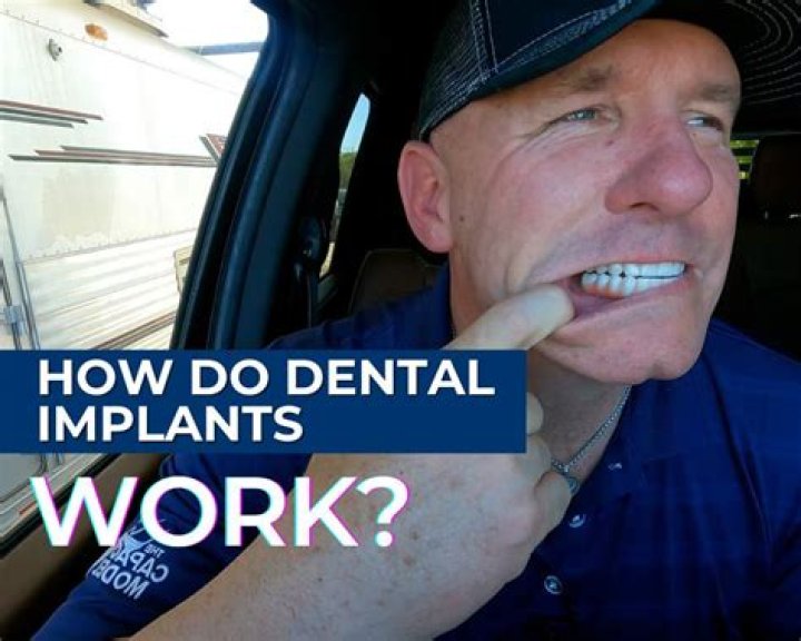 How do implants look when lying down?