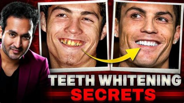 How do movie stars get such white teeth?
