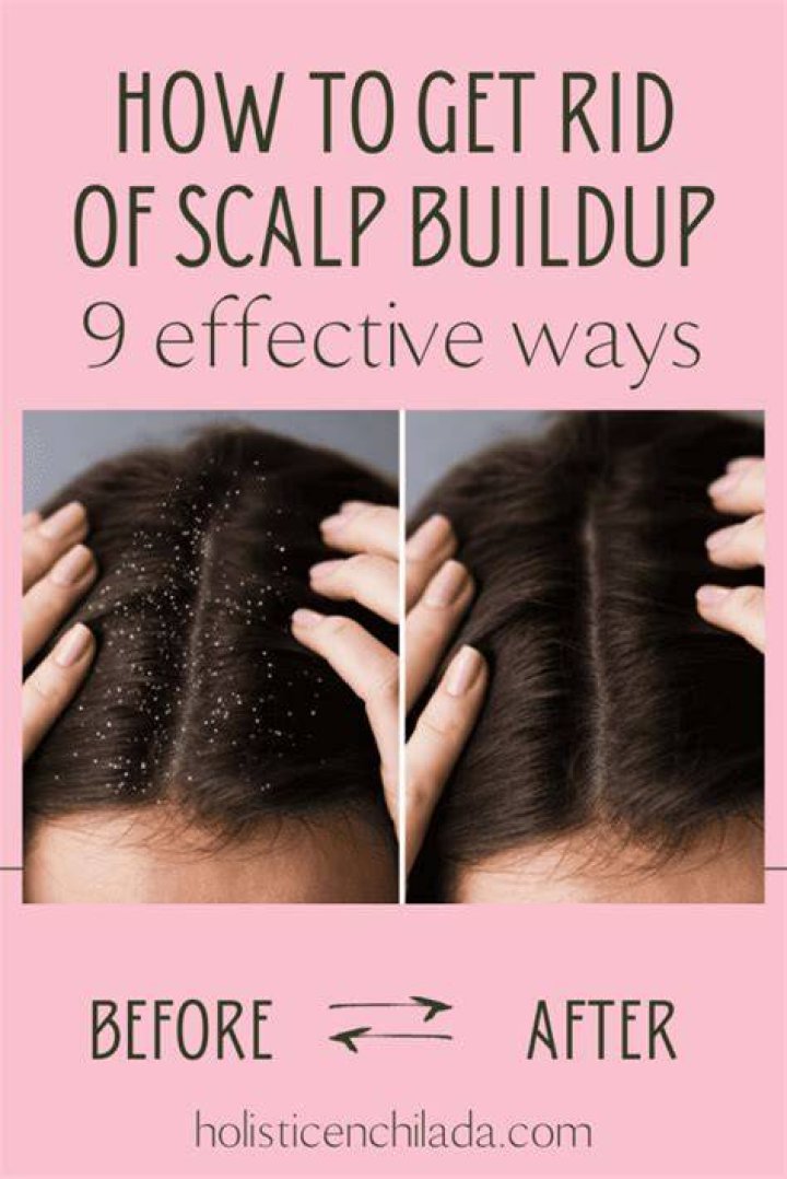 How do you get rid of buildup on dreads?