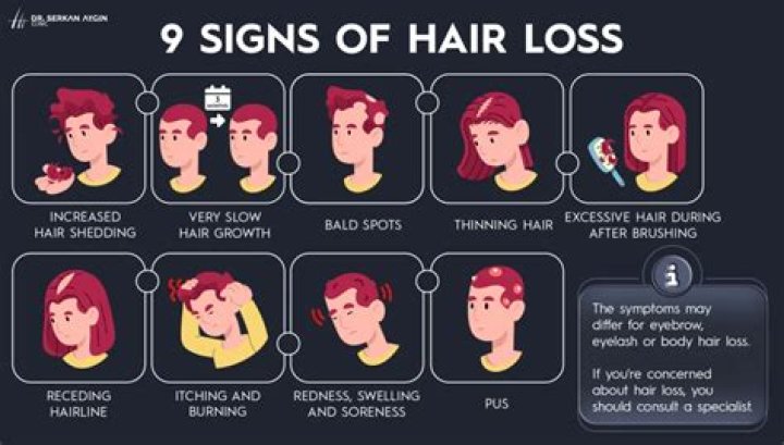 How do you know if you're losing too much hair?