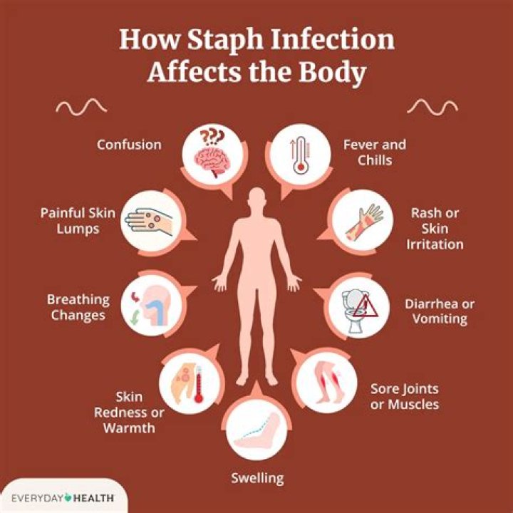 How do you know if you have an infection in your body?