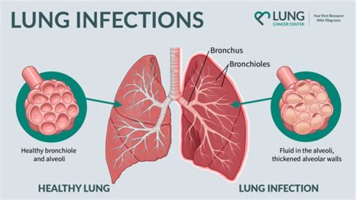 How do you know if your tongue has an infection?