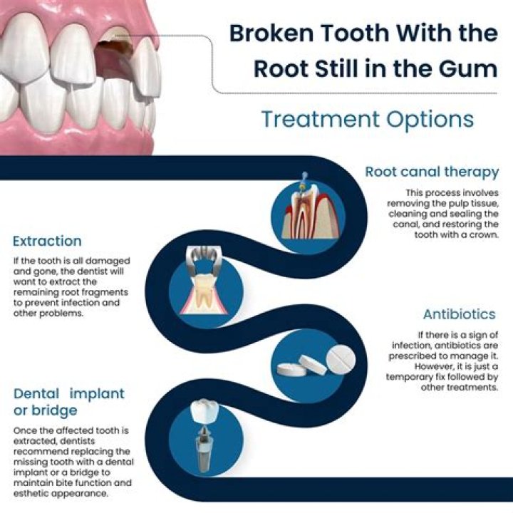 How do you remove a broken tooth from the gum line?