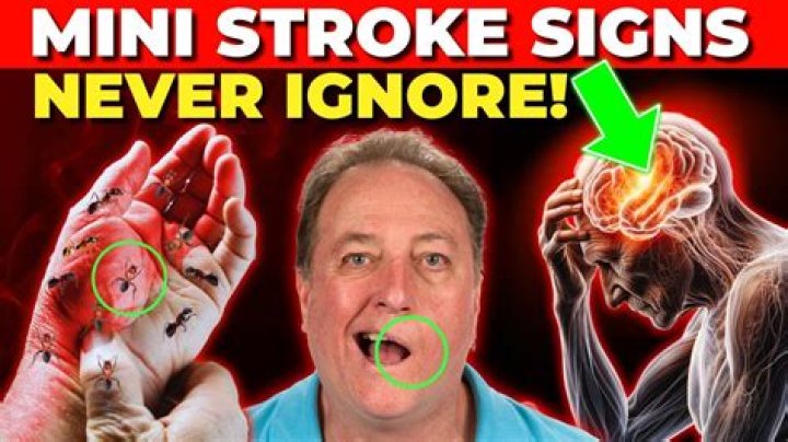 How do you tell if you've had a mini stroke?