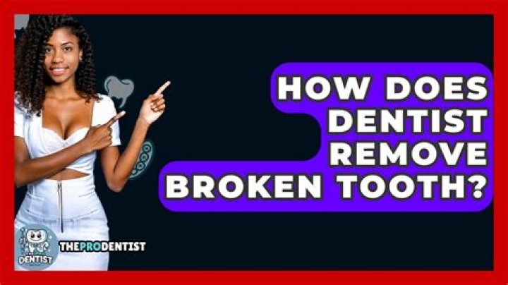 How does a dentist pull a broken tooth?