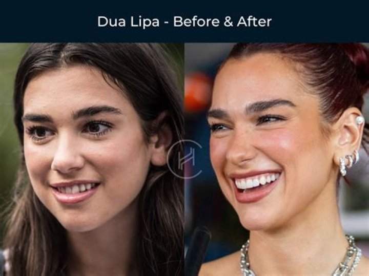 How does everyone in Hollywood have perfect teeth?