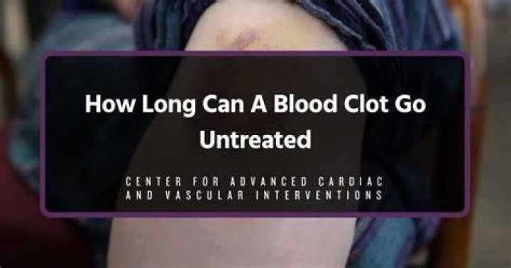 How long can a blood clot go untreated?