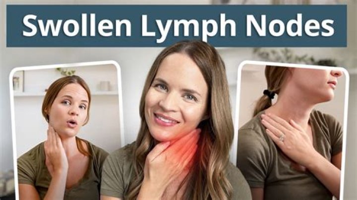 How long can a lymph node stay swollen?