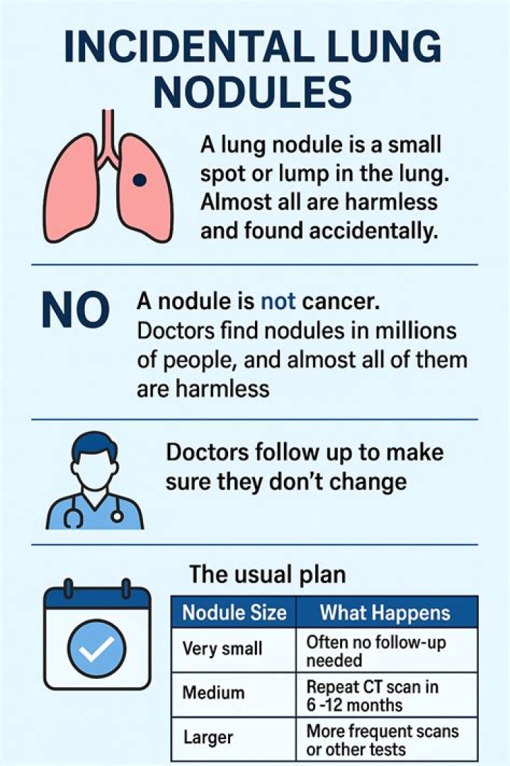 How long can you live with lung nodules?