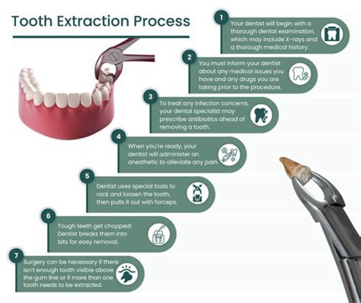 How long do you have to wait to give oral after tooth extraction?