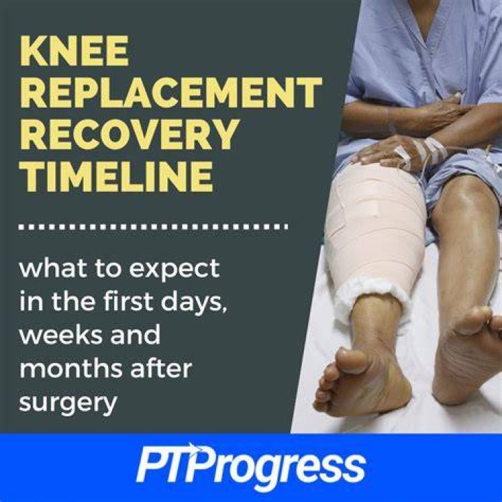How long do you need a caregiver after knee replacement surgery?