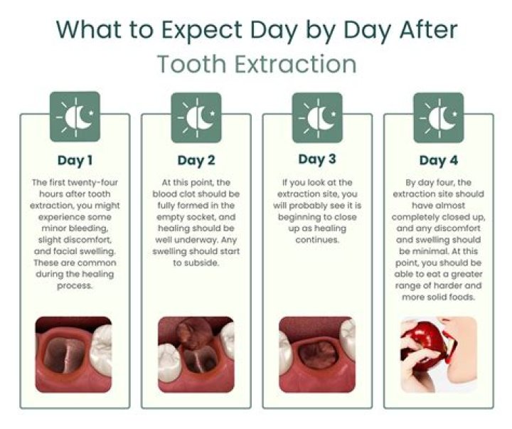 How long does face hurt after tooth extraction?