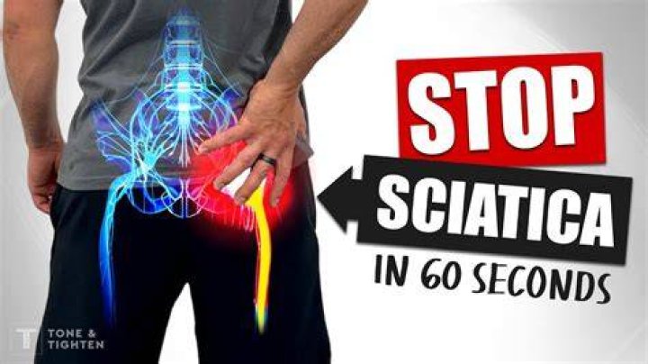 How long does it take for a sciatic nerve to go back to normal?