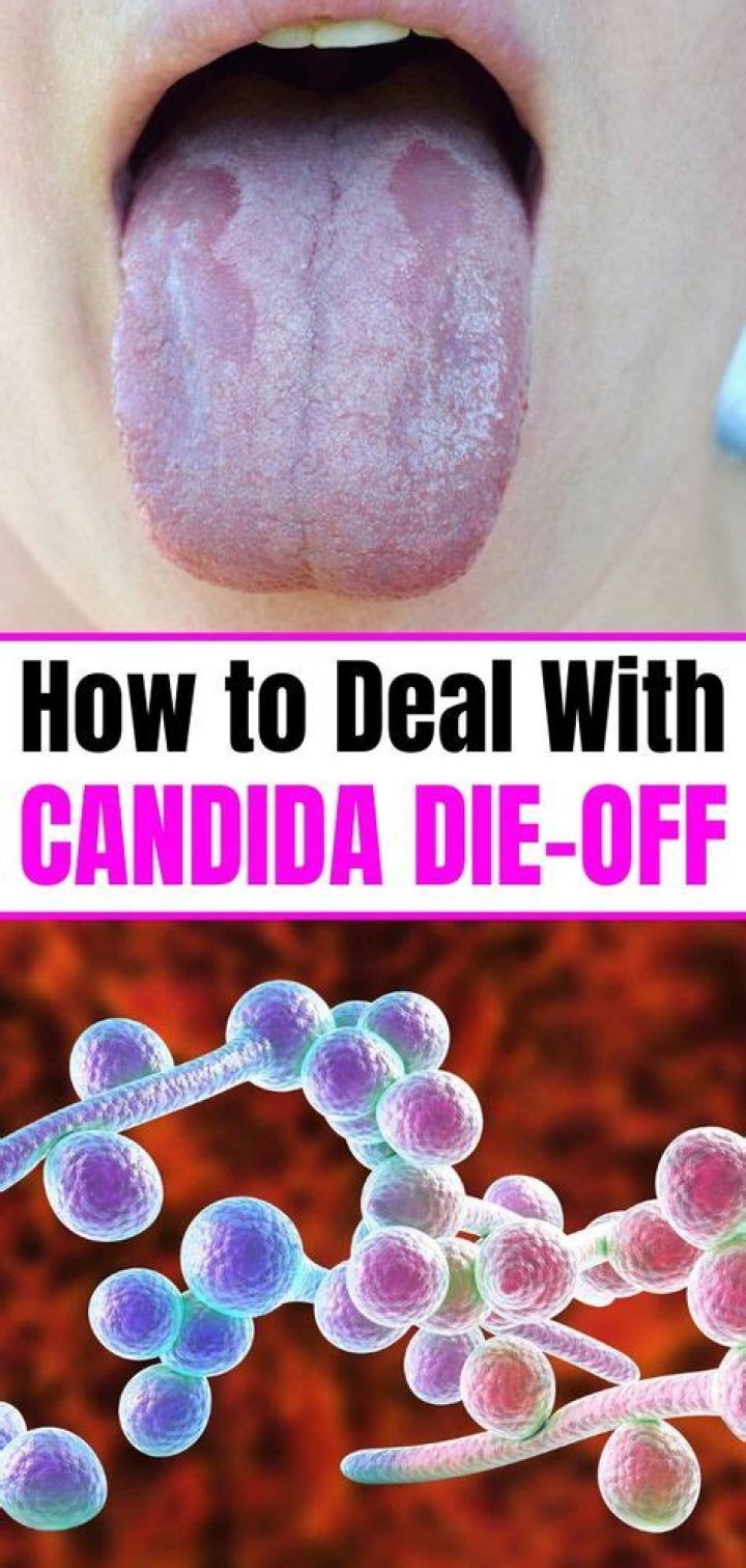 How long does it take to get rid of Candida?