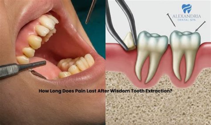 How long does swelling last after gum surgery?