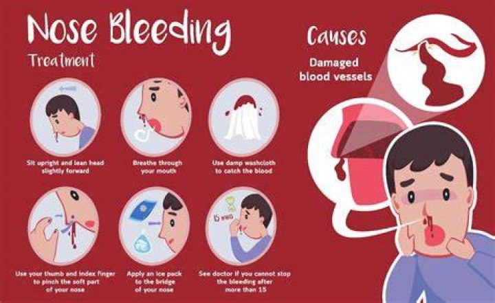 How many nosebleeds is too many?