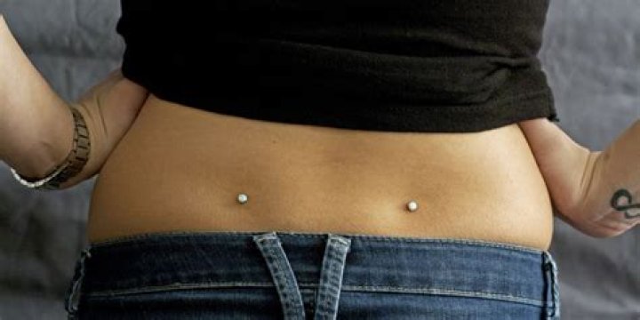 How much is a dimple removal?