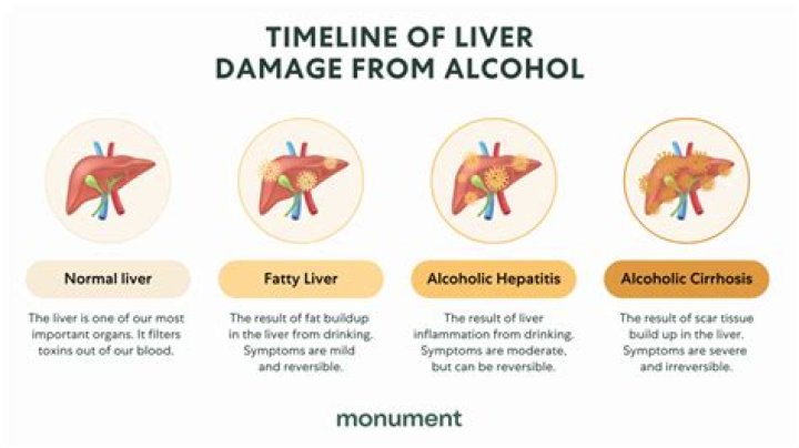 How much wine a day causes liver damage?