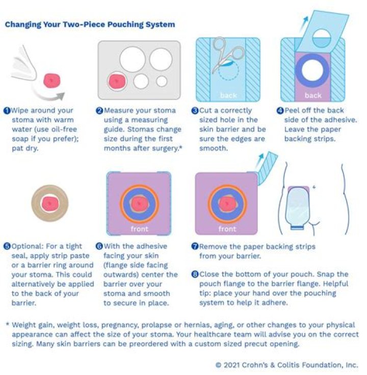 How often should a colostomy pouch be changed?