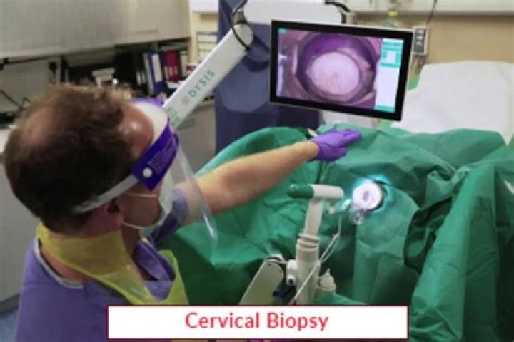 How painful is a cervical biopsy?