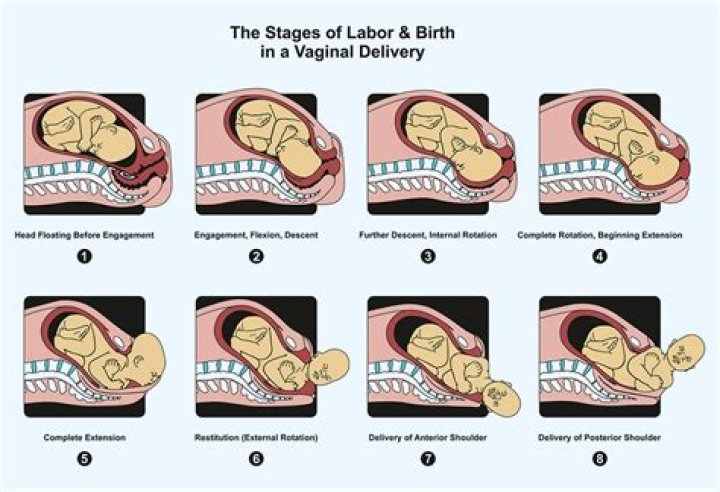 How painful is delivery of a baby?